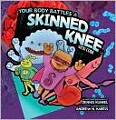 Your Body Battles a Skinned Knee