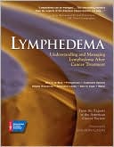 Lymphedema: Understanding and Managing Lymphedema after Cancer Treatment
