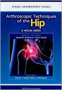 Arthroscopic Techniques of the Hip: A Visual Guide