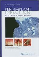 Peri-Implant Infection: Etiology, Diagnosis and Treatment