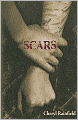 Scars