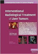 Interventional Radiological Treatment of Liver Tumors