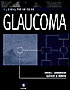 Clinical Pathways in Glaucoma