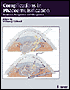 Complications in Phacoemulsification: Avoidance, Recognition, and Management