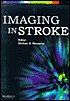 Imaging in Stroke