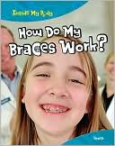 How Do Braces Work?: Teeth