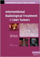 Interventional Radiological Treatment of Liver Tumors