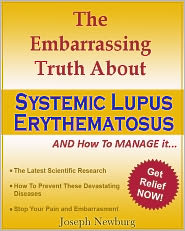 The Embarrassing Truth About Systemic Lupus Erythematosus (SLE) and How to Manage It by Joseph Newburg: NOOK Book Cover
