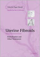 Uterine Fibroids: Embolization and other Treatments