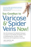 Say Goodbye to Varicose and Spider Veins Now!