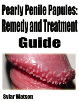 Permanent link: Pearly penile papules cream in india online. 