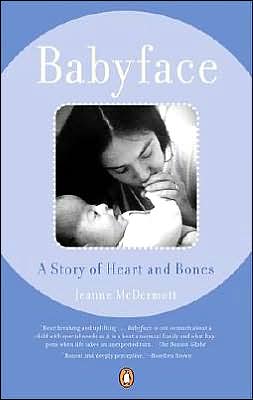 Babyface: A Story of Heart and Bones Jeanne McDermott