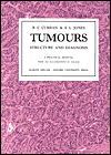 Tumors: Structure and Diagnosis