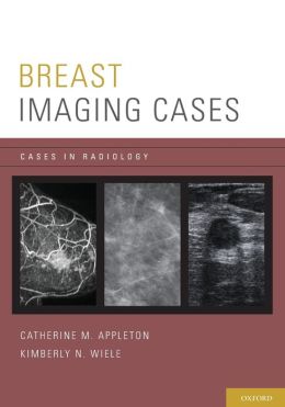 Breast Imaging Cases (Cases in Radiology) Catherine M. Appleton and Kimberly N. Wiele