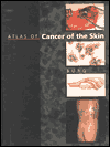 Atlas of Cancer of the Skin