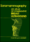 Sonomammography: An Atlas of Comparative Breast Ultrasound P. B. Guyer and Keith C. Dewbury