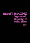 Breast Imaging: Diagnosis and Morphology of Breast Diseases Robert L. Egan