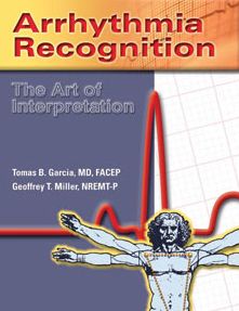 Arrhythmia Recognition: The Art Of Interpretation