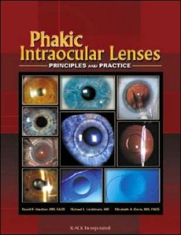 Phakic Intraocular Lenses: Principles and Practice