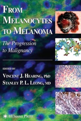 FROM MELANOCYTES TO MELANOMA Hearing, Vincent J.