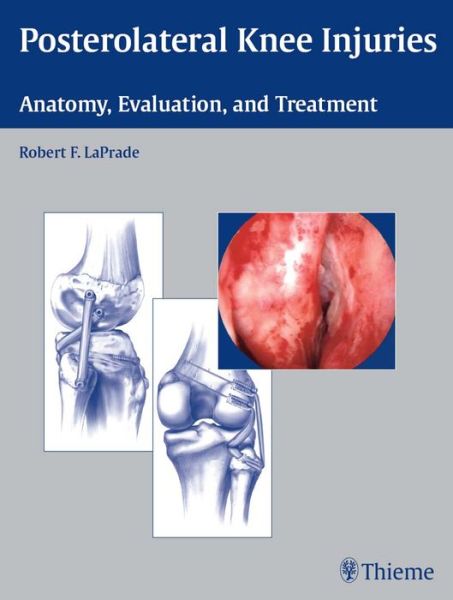 Free pdf books download for ipad Posterolateral Knee Injuries: Anatomy, Evaluation, and Treatment  by Robert F. LaPrade in English