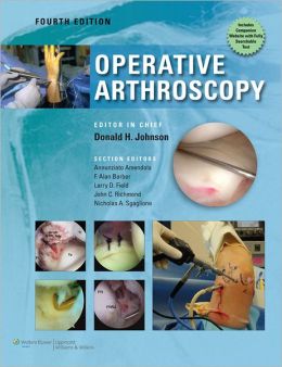 Operative Arthroscopy Don Johnson, Ned Annuziato Amendola, F Barber and Larry Field