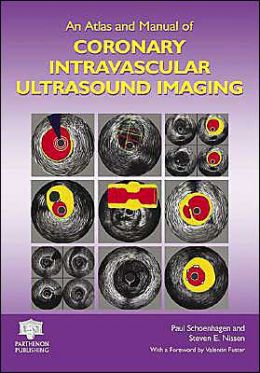 An Atlas and Manual of Coronary Intravascular Ultrasound Imaging Paul Schoenhagen, Steven E. Nissen