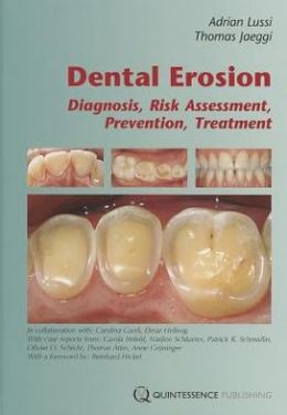 Dental Erosion: Diagnosis, Risk Assessment, Prevention, Treatment Thomas Jaeggi
