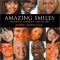 Amazing Smiles Through Cosmetic Dentistry