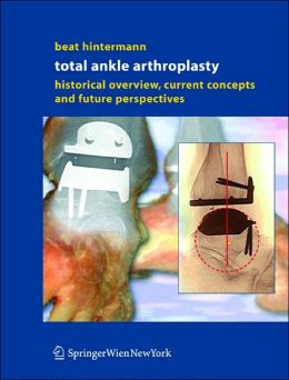 Total Ankle Arthroplasty: Historical Overview, Current Concepts and Future Perspectives Beat Hintermann