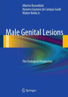 Male Genital Lesions: The Urological Perspective Alberto Rosenblatt, Homero Gustavo de Campos Guidi and Walter Belda Jr.